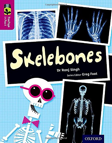 inFact 10 Skelebones inFact 10 Skelebones