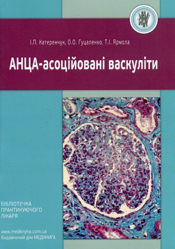 АНЦА-асоційовані васкуліти АНЦА-асоційовані васкуліти