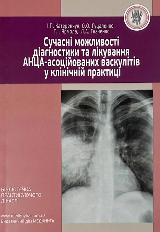 Сучасні можливості діагностики та лікування АНЦА-асоційованих васкулітів у клінічній практиці Сучасні можливості діагностики та лікування АНЦА-асоційованих васкулітів у клінічній практиці